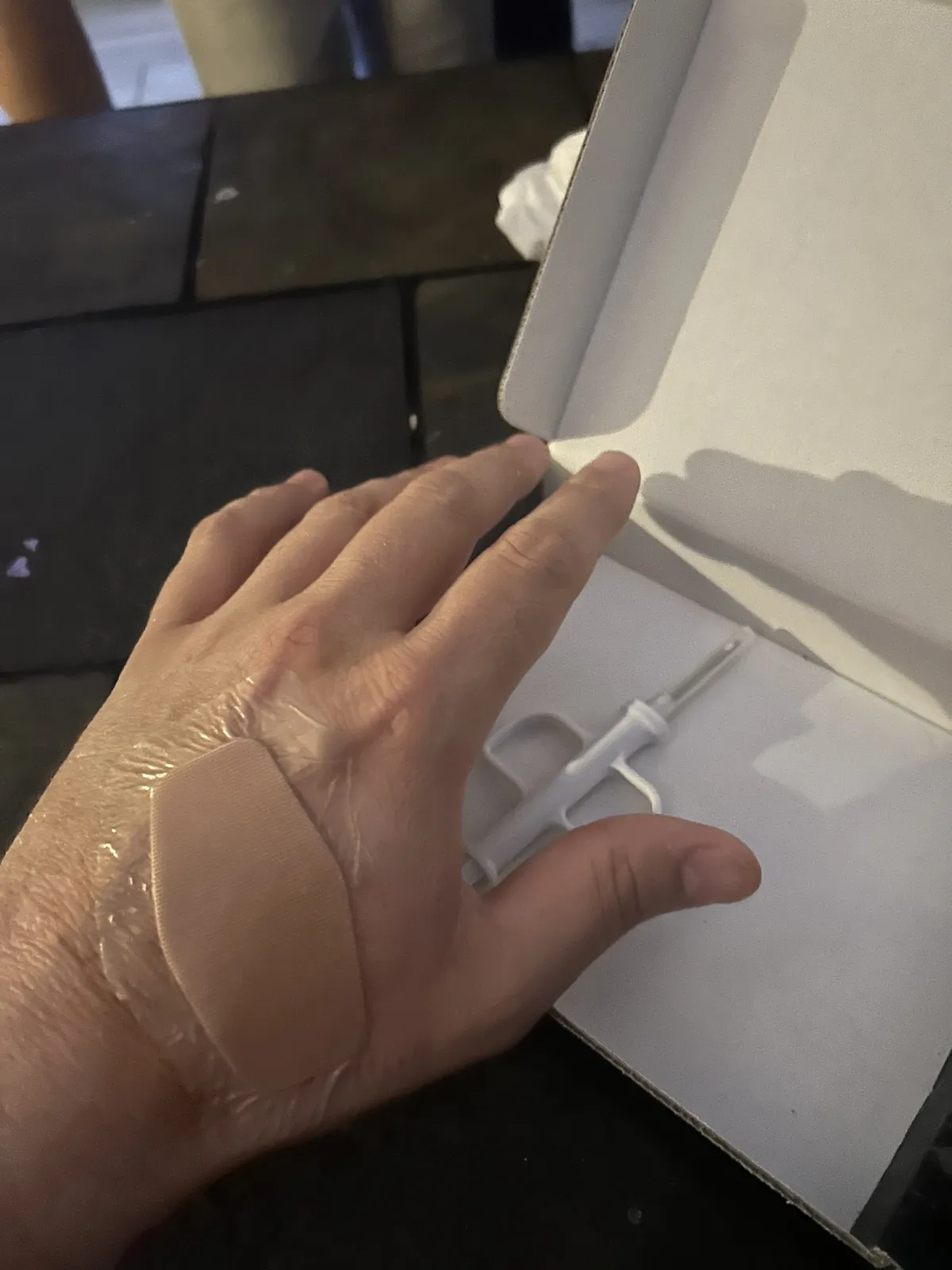 Hand showing implanted NFC chip location